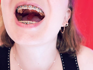 Asmr With Braces - Chewing Jelly Bears - Vore Fetish
